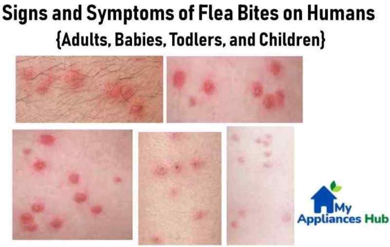 flea-bites