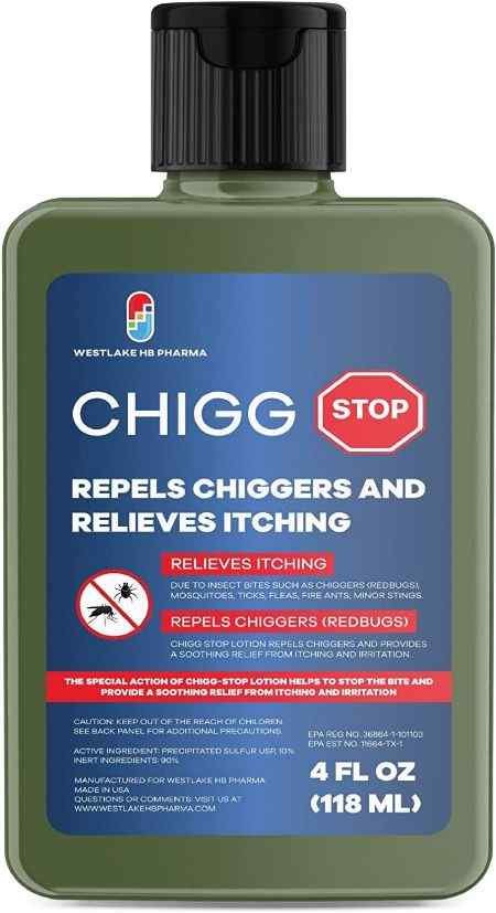 Chiggers 101: Symptoms, Prevention, Treatment, and Control of Chigger Bites