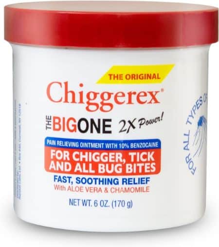 chiggers-in-shoes